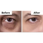 کرم دور چشم شیسیدو Vital Perfection