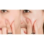 آمپول ضد چروک و حجم‌دهنده ۱۰۰ میل پپتید ۹ مدی پیل MediPeel