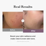 تونر شیری و درخشان کننده مدیکوب ایج آر گلوتاتیون