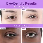 قبل و بعد ست مراقبت روزانه دور چشم نامبوزین9