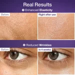 خرید ست سرم و ماسک لیفتینگ نامبوزین