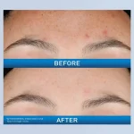 خرید سرم رتینول جوان‌کننده سراوی