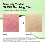 خرید پد تسکین‌دهنده قرمزی هیالورون آزلائیک ۱۰ آنواAnua