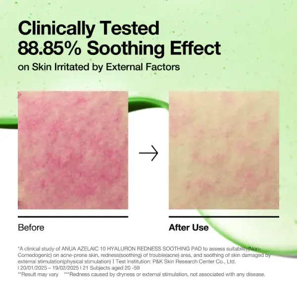 خرید پد تسکین‌دهنده قرمزی هیالورون آزلائیک ۱۰ آنواAnua