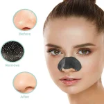 قیمت چسب پاک‌کننده جوش‌های سرسیاه بینی ویت