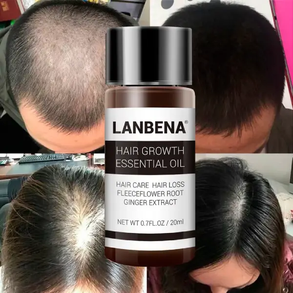 خرید روغن رشد و تقویت مو لانبنا LANBENA