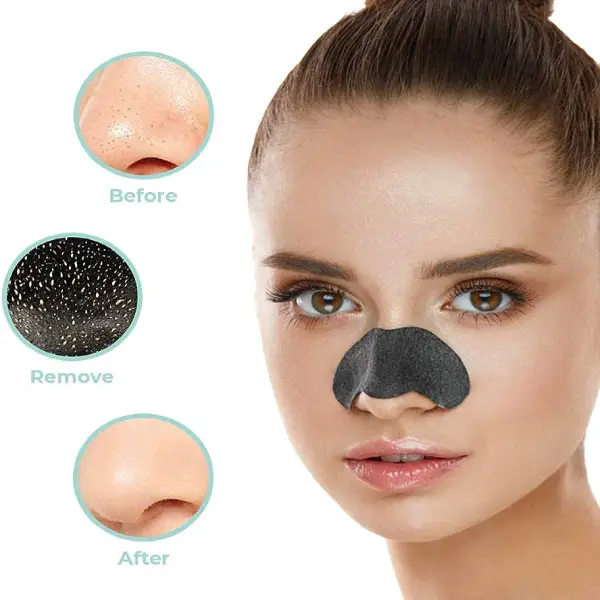 قیمت چسب پاک‌کننده جوش‌های سرسیاه بینی ویت