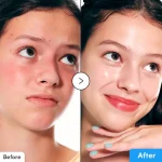 فروش سرم آبرسان و ترمیم‌کننده هیالتوئین اکوال‌بریEqqualberry