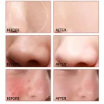 فروش سرم روشن‌کننده و کوچک‌کننده منافذ تیام