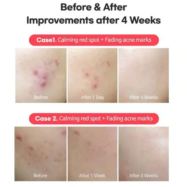 قیمت کرم نقطه‌ای ضدلک و ضدجوش تیام