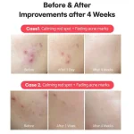 فروش کرم نقطه‌ای ضدلک و ضدجوش تیام