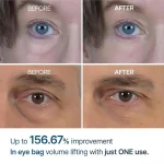 فروش کرم دور چشم دواثر ترانگزامیک اسید و رتینال‌سوم Dr Melaxin