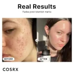 سرم نیاسینامید اسید کوزارکس
